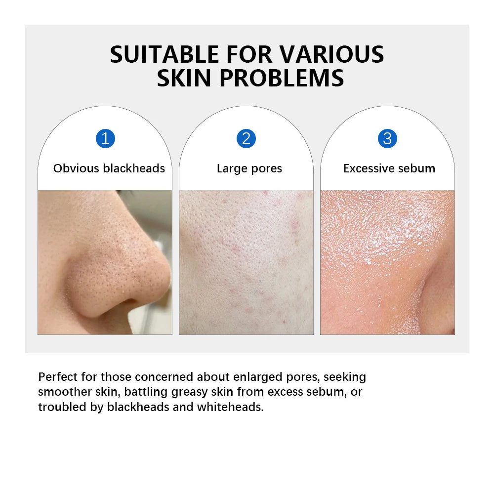 Zero Pore Pad 2.0 Double Textured Facial Toner For Exfoliating And Smoothing Pore Skin Care Pad For All Skin Types 70pcs
